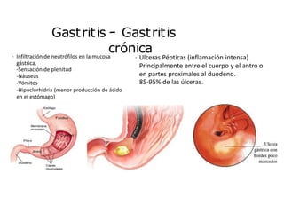Gastritis – Gastritis
crónica
• Infiltración de neutrófilos en la mucosa
gástrica.
-Sensación de plenitud
-Náuseas
-Vómitos
-Hipoclorhidria (menor producción de ácido
en el estómago)
• Ulceras Pépticas (inflamación intensa)
Principalmente entre el cuerpo y el antro o
en partes proximales al duodeno.
85-95% de las úlceras.
 