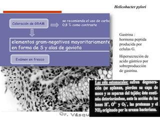 Helicobacter pylori




   Gastrina :
   hormona peptida
   producida por
   celulas G.
   Hipersecreción de
   acido gástrico por
   sobreproducción
   de gastrina.
 