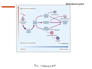 Helicobacter pylori
 