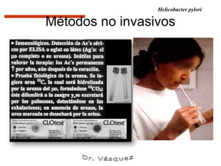 Helicobacter pylori

Métodos no invasivos
 