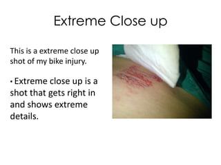 Extreme Close up
This is a extreme close up
shot of my bike injury.
• Extreme close up

is a
shot that gets right in
and shows extreme
details.

 