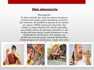 Mala alimentación
Descripción
La mala nutrición que vacía las reservas de grasas y
proteínas del cuerpo, puede desembocar en muerte
por inanición. En realidad, la mayoría de las muertes
por cáncer o SIDA ocurren por inanición. Aun
cuando el cuerpo obtuviera las calorías adecuadas,
una pérdida crónica de nutrientes específicos o una
incapacidad para usarlos, puede desembocar en una
enfermedad de insuficiencia. Por ejemplo, una
pérdida de proteínas puede ocasionar kwashiorkor,
enfermedad grave de insuficiencia, común entre niños
de países con graves problemas de alimentación.

 