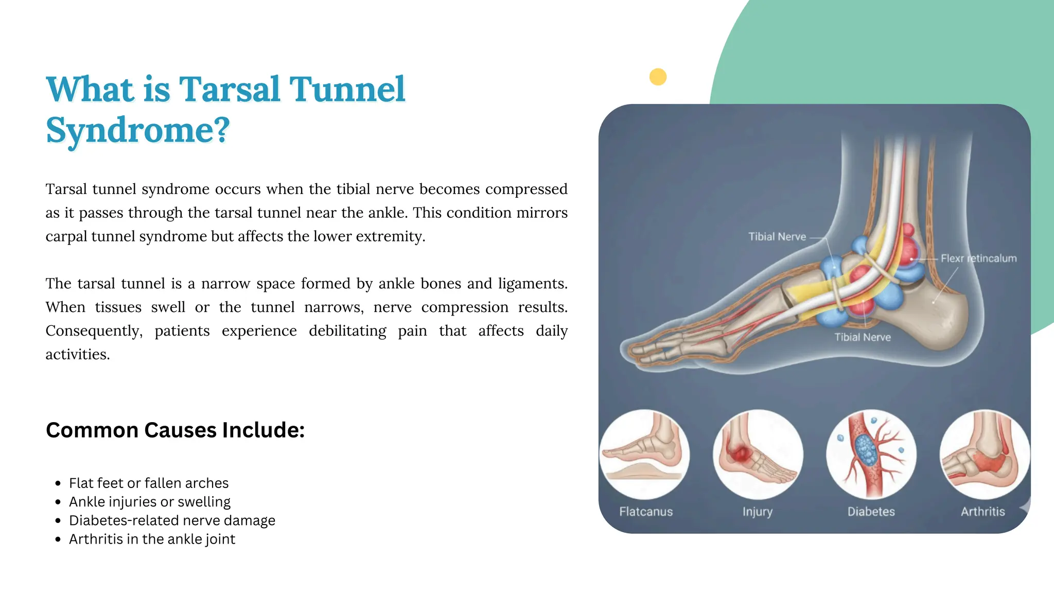 can-a-foot-and-ankle-doctor-treat-nerve-pain-case-study-of-tarsal
