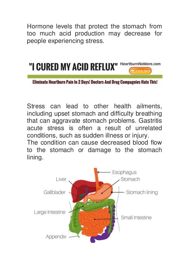 Can Stress Cause Heartburn?