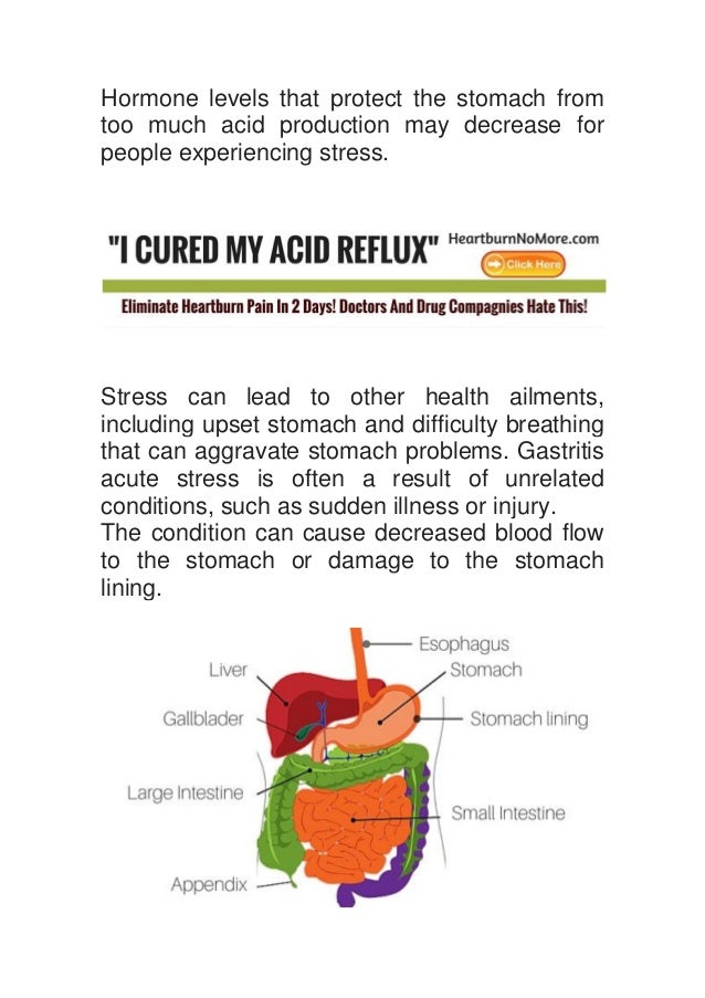 Can Stress Cause Heartburn? Can Stress Cause Heartburn?