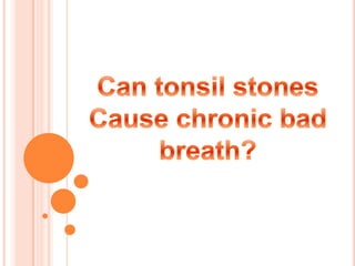 Can tonsil stones  Cause chronic bad breath? 