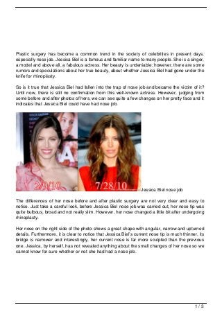 Plastic surgery has become a common trend in the society of celebrities in present days,
especially nose job. Jessica Biel is a famous and familiar name to many people. She is a singer,
a model and above all, a fabulous actress. Her beauty is undeniable; however, there are some
rumors and speculations about her true beauty, about whether Jessica Biel had gone under the
knife for rhinoplasty.

So is it true that Jessica Biel had fallen into the trap of nose job and became the victim of it?
Until now, there is still no confirmation from this well-known actress. However, judging from
some before and after photos of hers, we can see quite a few changes on her pretty face and it
indicates that Jessica Biel could have had nose job.




                                                                   Jessica Biel nose job

The differences of her nose before and after plastic surgery are not very clear and easy to
notice. Just take a careful look, before Jessica Biel nose job was carried out, her nose tip was
quite bulbous, broad and not really slim. However, her nose changed a little bit after undergoing
rhinoplasty.

Her nose on the right side of the photo shows a great shape with angular, narrow and upturned
details. Furthermore, it is clear to notice that Jessica Biel’s current nose tip is much thinner, its
bridge is narrower and interestingly, her current nose is far more sculpted than the previous
one. Jessica, by herself, has not revealed anything about the small changes of her nose so we
cannot know for sure whether or not she had had a nose job.




                                                                                                1/3
 