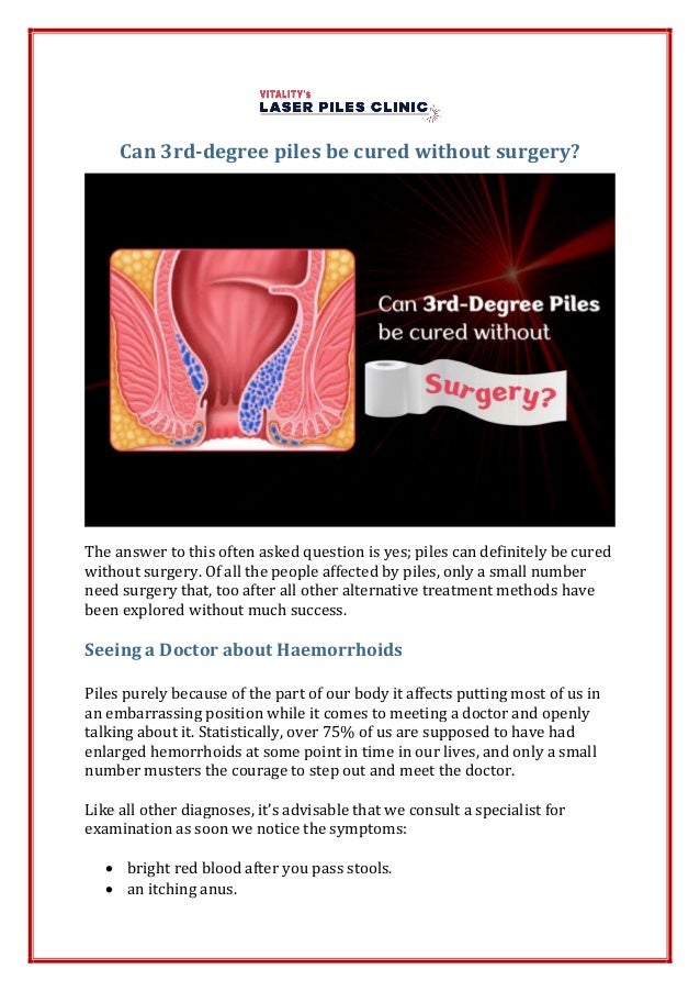 Can 3rddegree piles be cured without surgery?