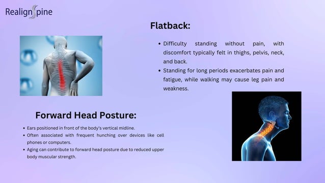 Spectacular Can A Chiropractor Help With Posture Abstract Illustration Spectacular Can A Chiropractor Help With Posture Abstract Illustration
