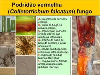 Podridão vermelha
(Colletotrichum falcatum) fungo
A. sintomas nas nervuras
centrais,
B. sinais do fungo na
nervura central,
C. organização acervular
emitida através das
aberturas estomatais,
D. detalhe do bulbo da
base do acérculo e setas
acerculares,
E. células conidiogênicas,
conídios e setas (Bar=40µ),
F. massa de conídios
hialinos (Bar=88µ),
G. conídio hialino, falcado,
amerosseptado e não
gutulado (Bar=9µ).
 