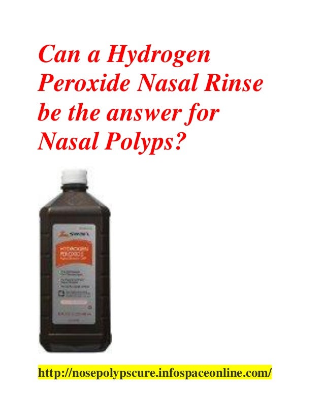 Can a hydrogen peroxide nasal rinse be the answer for nasal polyps
