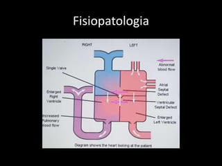 Fisiopatologia
 