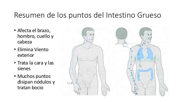 La hernia sheynogo del departamento la alimentación