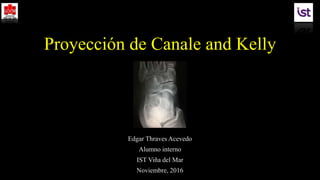 Proyección de Canale and Kelly
Edgar Thraves Acevedo
Alumno interno
IST Viña del Mar
Noviembre, 2016
 