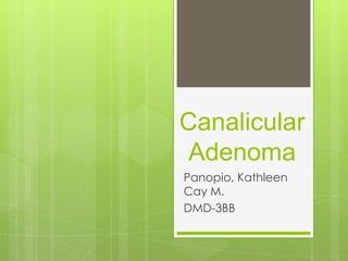 Canalicular
Adenoma
Panopio, Kathleen
Cay M.
DMD-3BB

 