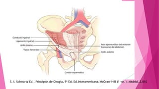 S. I. Schwartz Ed., Principios de Cirugía. 9ª Ed. Ed.Interamericana/McGraw-Hill (1 vol.). Madrid, 2.010
 