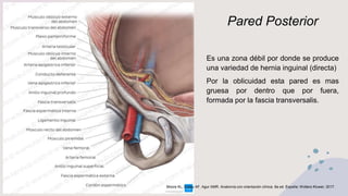 Pared Posterior
Es una zona débil por donde se produce
una variedad de hernia inguinal (directa)
Por la oblicuidad esta pared es mas
gruesa por dentro que por fuera,
formada por la fascia transversalis.
Moore KL, Dalley AF, Agur AMR. Anatomía con orientación clínica. 8a ed. España: Wolters Kluwer; 2017.
 