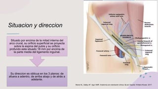 Situacion y direccion
Su direccion es oblicua en los 3 planos: de
afuera a adentro, de arriba abajo y de atrás a
adelante.
Situado por encima de la mitad interna del
arco crural, su orificio superficial se proyecta
sobre la espina del pubis y su orificio
profundo esta situado 18 mm por encima de
la parte media del ligamento inguinal.
Moore KL, Dalley AF, Agur AMR. Anatomía con orientación clínica. 8a ed. España: Wolters Kluwer; 2017.
 