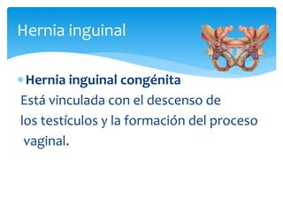 Hernia inguinal
Hernia inguinal congénita
Está vinculada con el descenso de
los testículos y la formación del proceso
vaginal.
 