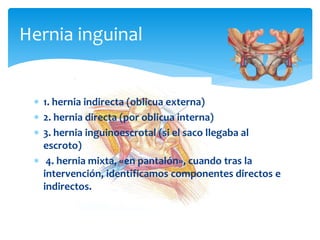 Hernia inguinal
 1. hernia indirecta (oblicua externa)
 2. hernia directa (por oblicua interna)
 3. hernia inguinoescrotal (si el saco llegaba al
escroto)
 4. hernia mixta, «en pantalón», cuando tras la
intervención, identificamos componentes directos e
indirectos.
 