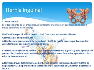 Hernia inguinal
 Hernia crural
Es independiente de las anteriores, con diferente tratamiento y con la salida del saco a
través del orificio o anillo crural.
Clasificación específica de la hernia crural. Conceptos anatómicos clásicos
Anomalías del orificio de salida
a. Hernia crural prevascular o de Hesselbach (1806). La hernia penetra por fuera de los
vasos femorales por la parte externa del anillo.
b. Hernia retrovascular de Serafini (1917). Se describió tras una auptosia y es lo opuesto a la
prevascular, donde el saco desciende por detrás de los vasos femorales y por dentro de la
vaina de la vena femoral.
c. Hernias a través del ligamento de Gimbernat, también llamadas de Laugier (1833)o de
Velpeau (1839). Sale por un orificio labrado sobre el ligamento de Gimbernat o ligamento
lacunar.
 