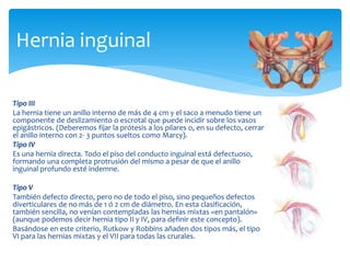 Tipo III
La hernia tiene un anillo interno de más de 4 cm y el saco a menudo tiene un
componente de deslizamiento o escrotal que puede incidir sobre los vasos
epigástricos. (Deberemos fijar la prótesis a los pilares o, en su defecto, cerrar
el anillo interno con 2- 3 puntos sueltos como Marcy).
Tipo IV
Es una hernia directa. Todo el piso del conducto inguinal está defectuoso,
formando una completa protrusión del mismo a pesar de que el anillo
inguinal profundo esté indemne.
Tipo V
También defecto directo, pero no de todo el piso, sino pequeños defectos
diverticulares de no más de 1 ó 2 cm de diámetro. En esta clasificación,
también sencilla, no venían contempladas las hernias mixtas «en pantalón»
(aunque podemos decir hernia tipo II y IV, para definir este concepto).
Basándose en este criterio, Rutkow y Robbins añaden dos tipos más, el tipo
VI para las hernias mixtas y el VII para todas las crurales.
Hernia inguinal
 