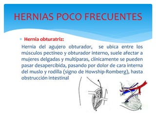 HERNIAS POCO FRECUENTES
 Hernia obturatriz:
Hernia del agujero obturador, se ubica entre los
músculos pectíneo y obturador interno, suele afectar a
mujeres delgadas y multíparas, clínicamente se pueden
pasar desapercibida, pasando por dolor de cara interna
del muslo y rodilla (signo de Howship-Romberg), hasta
obstrucción intestinal
 