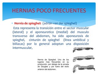 HERNIAS POCO FRECUENTES
 Hernia de spieghel: (adrián van der spieghel)
Esta representa la transición entre el sector muscular
(lateral) y el aponeurotico (medial) del musculo
transverso del abdomen, ha sido aponeurosis de
spieghel, cinturón de spieghel (línea umbilical y
biiliacas) por lo general adoptan una disposición
intermuscular,
Hernia de Spieghel. Uno de los
lugares mas frecuentes en su
producción, por debajo de la arcada
de Douglas y por fuera del recto
anterior del abdomen.
 
