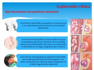 Qué situaciones nos podemos encontrar
Exploración clínica
Una hernia reductible es aquella en la que el saco
o su contenido puede devolverse a la cavidad
abdominal.
Una hernia irreductible o incarcerada es la que
no podemos devolver al interior de la cavidad,
pero no hay inflamación del saco o su contenido,
ni dificultad en el riego sanguíneo de la misma.
Una hernia estrangulada es aquella irreductible,
que suele presentarse de forma aguda y con
dolor producido por falta de riego sanguíneo; es
el dolor agudo de la isquemia
 