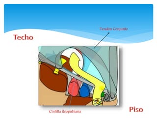 Tendón Conjunto
Cintilla ileopubiana
 
