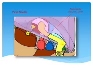 Pared Anterior
Aponeurosis
Oblicuo Mayor
 