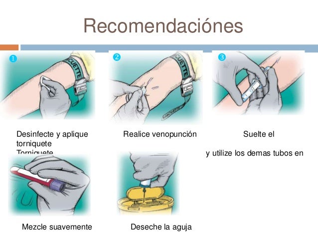 Resultado de imagen para venopunción tecnica