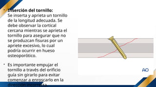 Canal liso.pptx como hacer un canal liso | PPTX