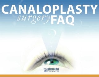 surgery
CANALOPLASTY
FAQ
?
? ?
 