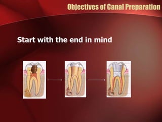 Objectives of Canal Preparation
Start with the end in mind
 