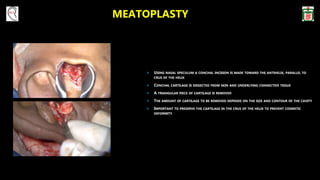 MEATOPLASTY
 USING NASAL SPECULUM A CONCHAL INCISION IS MADE TOWARD THE ANTIHELIX, PARALLEL TO
CRUS OF THE HELIX
 CONCHAL CARTILAGE IS DISSECTED FROM SKIN AND UNDERLYING CONNECTIVE TISSUE
 A TRIANGULAR PIECE OF CARTILAGE IS REMOVED
 THE AMOUNT OF CARTILAGE TO BE REMOVED DEPENDS ON THE SIZE AND CONTOUR OF THE CAVITY
 IMPORTANT TO PRESERVE THE CARTILAGE IN THE CRUS OF THE HELIX TO PREVENT COSMETIC
DEFORMITY
 