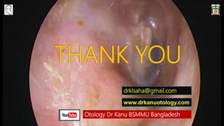 THANK YOU
Otology Dr Kanu BSMMU Bangladesh
drklsaha@gmail.com
www.drkanuotology.com
 
