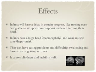 Effects
Infants will have a delay in certain progress, like turning over,
being able to sit up without support and even turning their
head.

Infants have a large head (macrocephaly) and weak muscle
tone (hypotonia).

They can have eating problems and diﬃculties swallowing and
have a risk of getting seizures.

It causes blindness and inability walk.
 