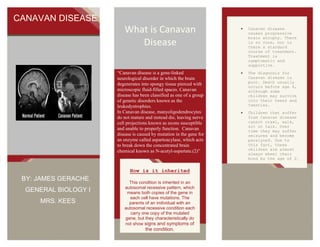 CANAVAN DISEASE

What is Canavan
Disease

Canavan disease
causes progressive
brain atrophy. There
is no cure, nor is
there a standard
course of treatment.
Treatment is
symptomatic and
supportive.

“Canavan disease is a gene-linked
neurological disorder in which the brain
degenerates into spongy tissue pierced with
microscopic fluid-filled spaces. Canavan
disease has been classified as one of a group
of genetic disorders known as the
leukodystrophies.
In Canavan disease, manyoligodendrocytes
do not mature and instead die, leaving nerve
cell projections known as axons susceptible
and unable to properly function. Canavan
disease is caused by mutation in the gene for
an enzyme called aspartoacylase, which acts
to break down the concentrated brain
chemical known as N-acetyl-aspartate.(2)”

The diagnosis for
Canavan disease is
poor. Death usually
occurs before age 4,
although some
children may survive
into their teens and
twenties.

How is it inherited

BY: JAMES GERACHE
GENERAL BIOLOGY I
MRS. KEES

This condition is inherited in an
autosomal recessive pattern, which
means both copies of the gene in
each cell have mutations. The
parents of an individual with an
autosomal recessive condition each
carry one copy of the mutated
gene, but they characteristically do
not show signs and symptoms of

the condition.

Children that suffer
from Canavan disease
cannot crawl, walk,
sit or talk. Over
time they may suffer
seizures and become
paralyzed. Due to
this fact, these
children are almost
always wheel chair
bond by the age of 2.

 