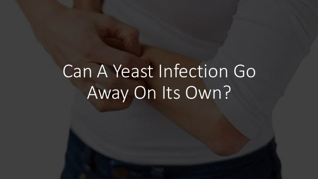 Can A Yeast Infection Go
Away On Its Own?
 