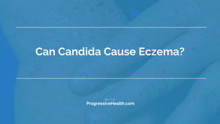 Can Candida Cause Eczema?
•W I T H
•ProgressiveHealth.com
 