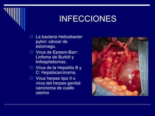 INFECCIONES La bacteria Helicobacter pylori: cáncer de estomago. Virus de Epstein-Barr: Linfoma de Burkitt y linfoepiteliomas. Virus de la Hepatitis B y C: Hepatocarcinoma. Virus herpes tipo II o virus del herpes genital: carcinoma de cuello uterino 
