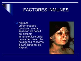 FACTORES INMUNES Algunas enfermedades conducen a una situación de déficit del sistema inmunológico son la causa del desarrollo de algunos canceres: SIDA: Sarcoma de Kaposi. 