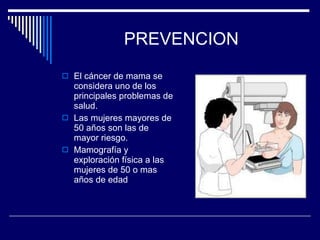 PREVENCION El cáncer de mama se considera uno de los principales problemas de salud. Las mujeres mayores de 50 a ñ os son las de mayor riesgo. Mamografía y exploración física a las mujeres de 50 o mas a ñ os de edad 