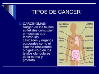 TIPOS DE CANCER CARCINOMAS: Surgen en los tejidos epiteliales como piel o mucosas que tapizan las cavidades y órganos corporales como el sistema respiratorio o digestivo o en los tejidos glandulares de la mama y próstata. 