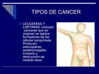 TIPOS DE CANCER LEUCEMIAS Y LINFOMAS: Incluyen  canceres que se originan en tejidos formadores de las células sanguíneas. Producen adenopatías, esplenomegalia, invasión y destrucción de medula ósea 