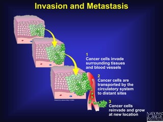 Invasion and Metastasis1Cancer cells invade surrounding tissues and blood vessels2Cancer cells are transported by the circulatory system to distant sites3Cancer cells reinvade and grow at new location