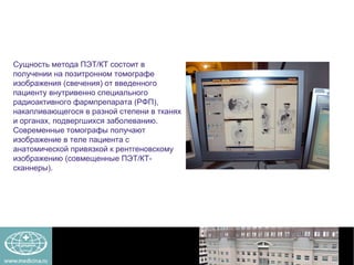 Сущность метода ПЭТ/КТ состоит в получении на позитронном томографе изображения (свечения) от введенного пациенту внутривенно специального радиоактивного фармпрепарата (РФП), накапливающегося в разной степени в тканях и органах, подвергшихся заболеванию. Современные томографы получают изображение в теле пациента с анатомической привязкой к рентгеновскому изображению (совмещенные ПЭТ/КТ-сканнеры). 