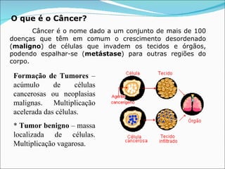 O que é o Câncer?   Câncer é o nome dado a um conjunto de mais de 100 doenças que têm em comum o crescimento desordenado ( maligno ) de células que invadem os tecidos e órgãos, podendo espalhar-se ( metástase ) para outras regiões do corpo. Formação de Tumores  – acúmulo de células cancerosas ou neoplasias malignas. Multiplicação acelerada das células. *  Tumor benigno  – massa localizada de células. Multiplicação vagarosa.  
