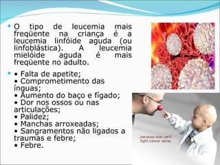 O tipo de leucemia mais freqüente na criança é a leucemia linfóide aguda (ou linfoblástica). A leucemia mielóide aguda é mais freqüente no adulto. •  Falta de apetite; • Comprometimento das ínguas; • Aumento do baço e fígado; • Dor nos ossos ou nas articulações; • Palidez; • Manchas arroxeadas; • Sangramentos não ligados a traumas e febre; • Febre. 